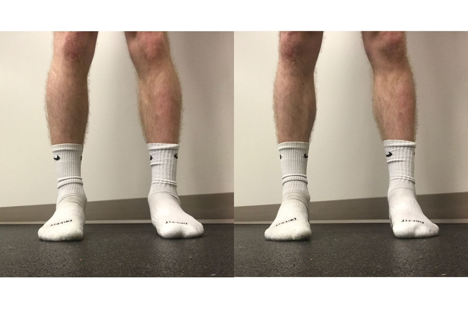Photo of standing arch flexion exercise to prevent shin splints